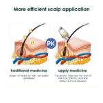 kf-S09addf7f24054339aefe5c693a2d6942z-Scalp-Applicator-Liquid-Comb-for-Hair-Scalp-Treatment-Essential-Oil-Guiding-Massager-Brush-Hair-Growth-Serum