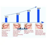 kf-Sa675f2d977604a61b0d6e5e36150ba0dw-GREATLH-Dental-Cold-Light-LED-Teeth-Whitening-Machine-Desk-Tooth-Bleaching-Lamp-Teeth-Whitening-Light-Dental