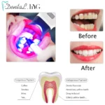kf-S64d4b1bfbc204807951c135b2f1e3cbd7-Dental-Cold-Light-Lamp-3Color-Teeth-Whitening-Machine-Bleaching-Accelerator-Device-LED-Light-Dentistry-Tool-With