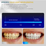 kf-S823d64f54871456bad99a939611b1dd4H-Version-2-0-Dental-Teeth-Whitening-Machine-10-LED-Beads-Removable-Holder-Bleaching-Light-Tooth-Whitener