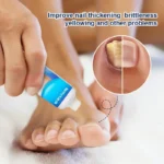 kf-S76c653305b934bc68e9669fac567ea015-Nail-Fungal-Cream-Treatment-Device-Repair-Toenail-Fingernail-Fungus-Treat-Onychomycosis-Laser-Nails-With-Mushrooms-Relaxation