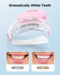 kf-S6e85cf96ec5d435a94fefb14e2c67586o-Fairywill-U-Shape-Gel-Teeth-Whitening-Strips-Set-Silicone-Sonic-Tooth-Cleansing-Brush-Intelligent-Oral-Care